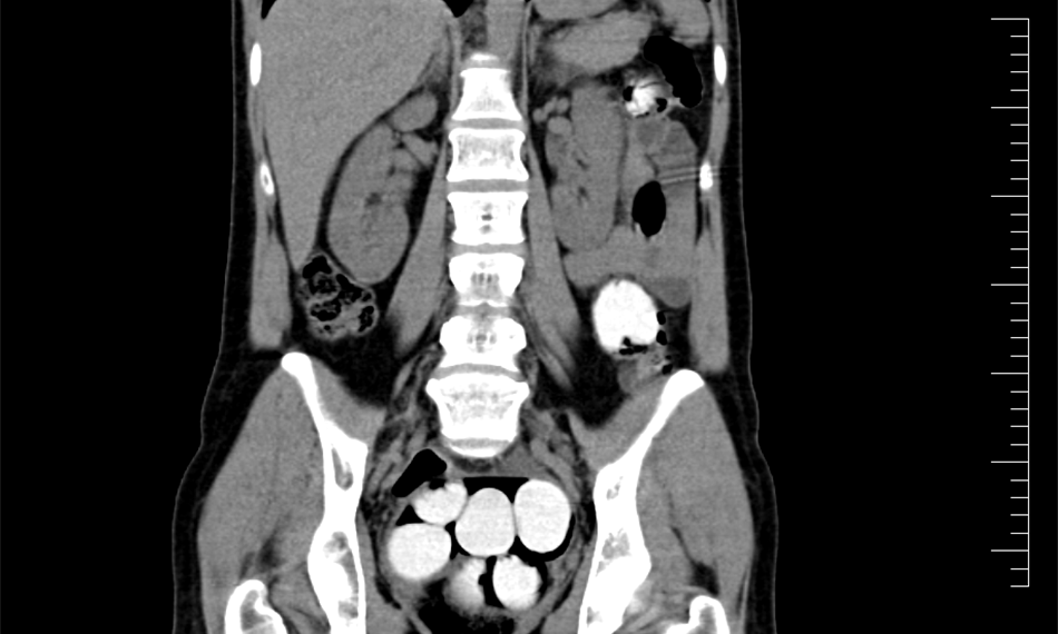 2017-10-4-947foto 2.png